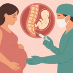 Epidural Doğum Nedir? Ağrısız Doğum Hakkında Merak Edilenler
